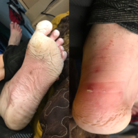 My feet are waterlogged from walking in soggy socks, and raw and blistery from being broken in. They will get worse before they get better. From this point on, I will be limping across NJ.