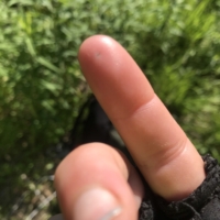 My back pain remains when I wake up. I awkwardly go to hoist myself out of bed, impossibly trying not to bend my back ... and pierce my finger on a thorn that I then can't remove. IQWNFKEJWBKMD KLGNRGDMFS KLNVDM <VFMGW$E