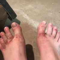 My feet are not looking hot. The leather of my boots is wearing into the base of my toes, rubbing them raw.