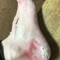 Sorry for the stinky foot picture, but I want to be honest on their condition, and there is no truer way than to just show them, in all their ooey gooey, cheesey glory (oh gosh, that description is making things even worse-again, sorry!)